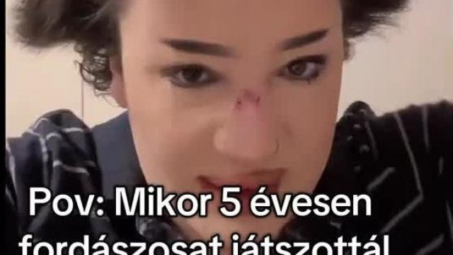 Prodigy Noryna próbál valamit csinálni a hajával