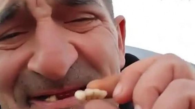 Kitörött fogú Sittes Tàky a nézőket kèri hogy segítsenek neki összedobni ùj fogakra