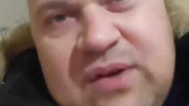MC Dentàl Holokauszt brutàlisan feldagadt Hörcsög pofazacskòval nem akar orvoshoz menni mert remèli hogy rendbe jön