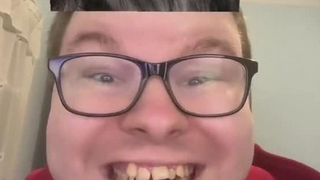 Dentál horror - Feriveri tökéletes mosolya még egy majoménál is ocsmányabb