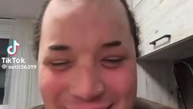 Norbert ráébredt milyen csúnya valójában