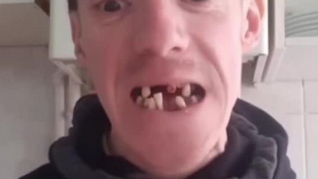 Újabb Horror Dentàl Holokauszt - mèg egy elesett katona tàvozott a Cseppkőbarlang fogsàgábòl