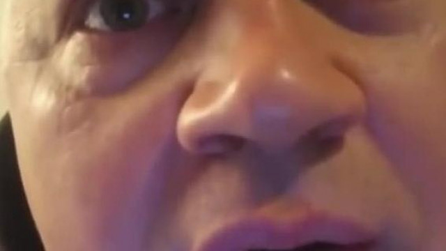 Orbitàlis Sertès szem Kigúvadàsok - Pszichòkènyi bizonygatja a rendes ember teòriàt ès ő semmit nem csinàlt