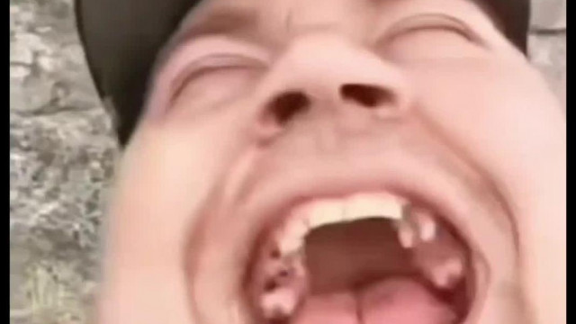 Ultrabrutàl Horrorisztikus miskolci Dentàl Holokauszt - csak erős idegzetű Trollégàknak