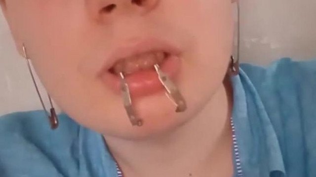 Szépségápolási tippek Dénes Benjámintól, a kommunista, vegán, autista buzitól.