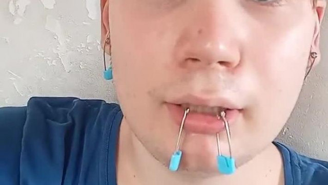 Dénes Benjámin, a gémkapocspofájú autista komcsi vegánhomár a haját simogatja 9 percen keresztül, és értelmetlenül makog