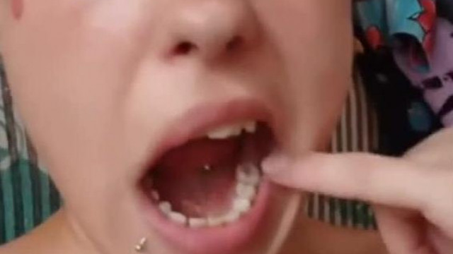 Üdvözlendő Hír - az Onlyfans üdvöskéjènek, Kinga lotyònak letörött a foga