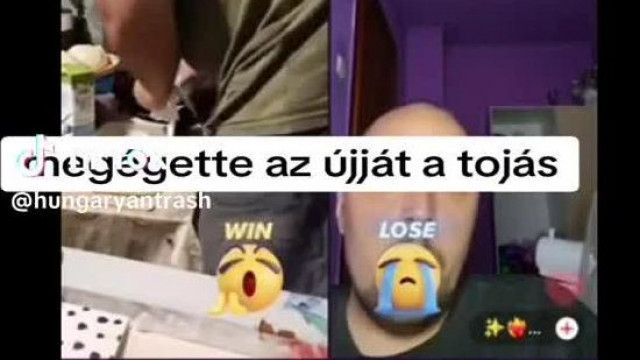 A gyerekvadász tojás megégette az ujját a sütővel